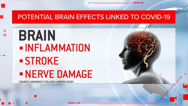 cbsn-fusion-study-reveals-brain-damage-may-be-linked-to-covid-19-thumbnail-514317-640x360.jpg 