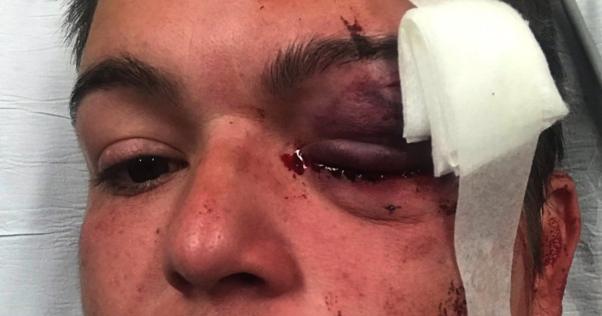 Minneapolis Settles With Journalist Blinded During Unrest Following