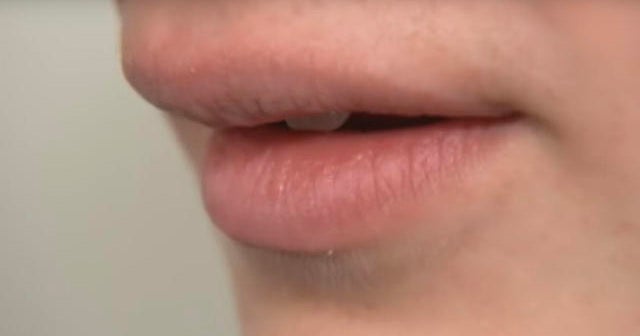 From 2011: Finding their voices – Understanding stuttering - CBS News