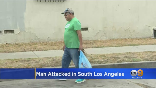 man-attacked.jpg 