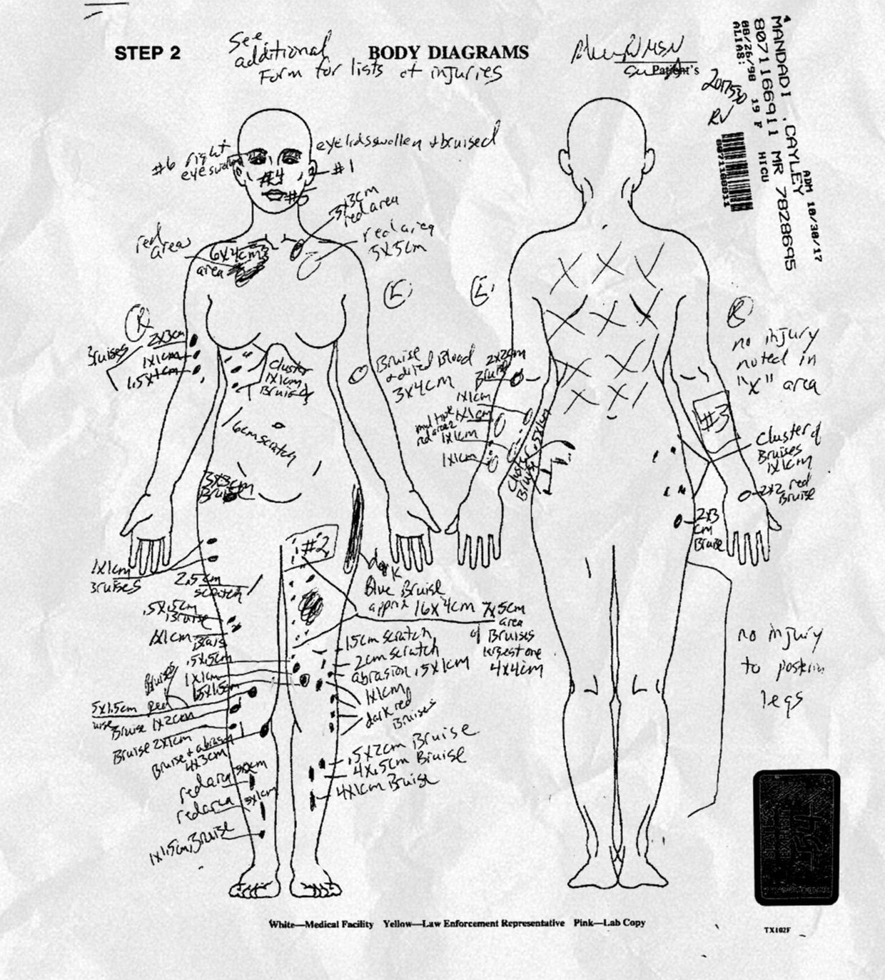 How did Texas teen Cayley Mandadi die? Her parents find a clue in her ...