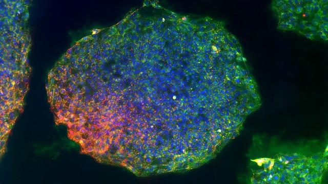 stem-cell-research-CIRM.jpg 