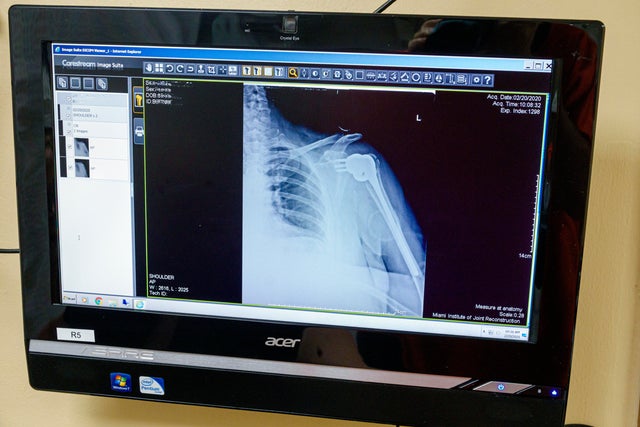 Florida, Miami Beach, broken shoulder, post operative x-ray