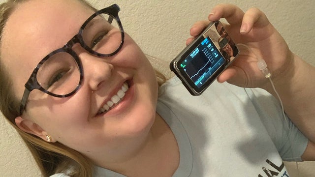 samantha-diabetes-insulin-pump.jpg 