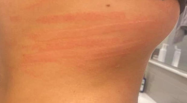 Fort Worth Oakmont Park Attack