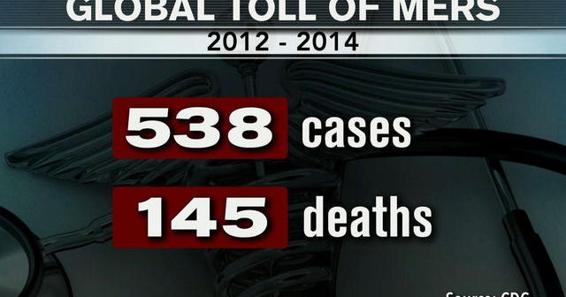 Second U S Case Of Mers Confirmed In Florida Cbs News Second U S Case Of Mers Confirmed In Florida Cbs News
