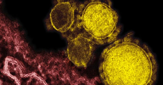 Just how dangerous is MERS? - CBS News