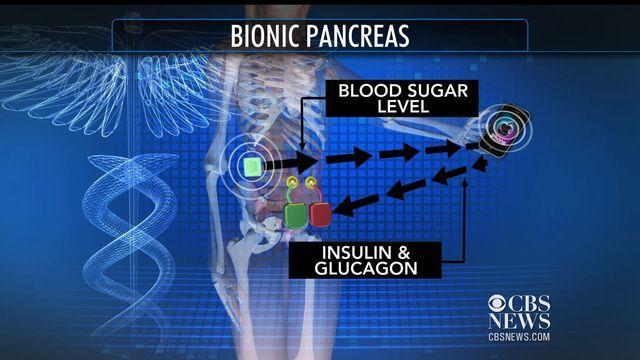 uttmgreen-diabetes061714-640x360.jpg 