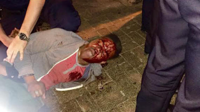 uva-student-beaten-by-police-officer-arrested-blood-face-360931-640x360.jpg 