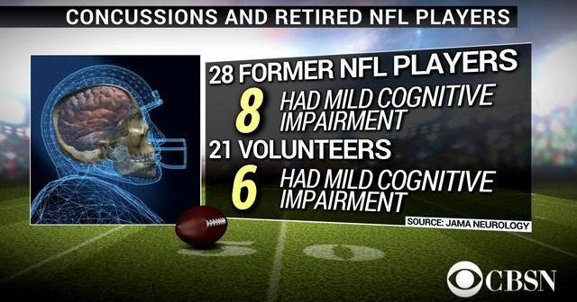 New study on long-term effects of football concussions - CBS News