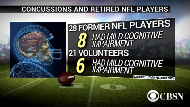 cbsn-0518-concussion-394393-640x360.jpg 