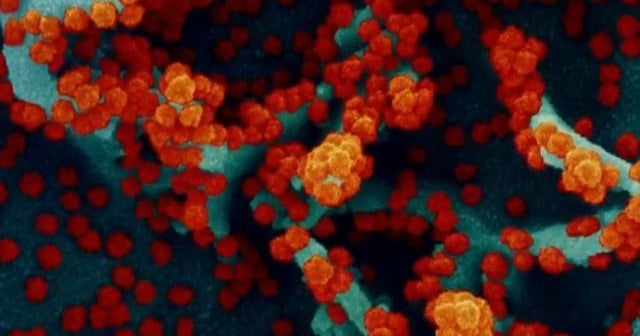 Surge in COVID cases tied to spread of U.K. variant - CBS News
