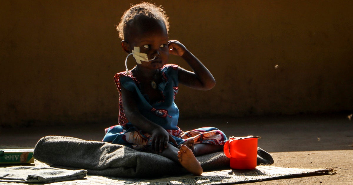 Global hunger crisis hit five year high in 2020 as 155 million people ...