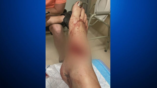 DOG ATTACK 5PKG.transfer_frame_1072 