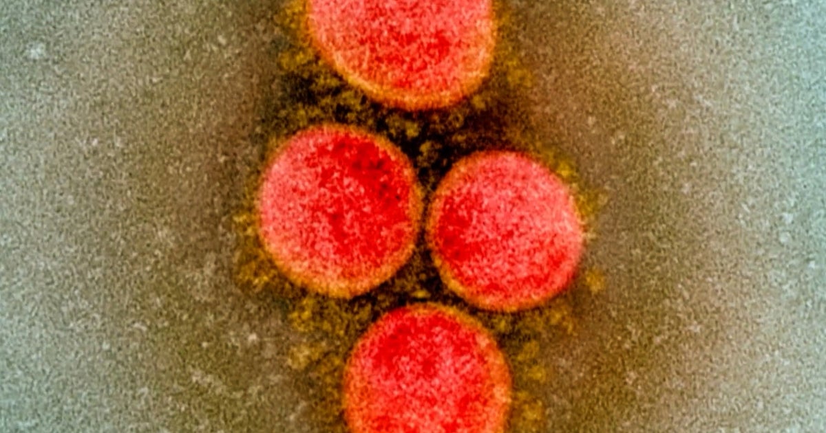 COVID19 In Maryland Cases Increase By More Than 300 In A Day CBS