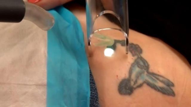 cbsn-fusion-tattoo-removal-procedures-spike-post-pandemic-thumbnail-744093-640x360.jpg 