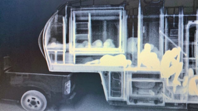 xray.jpg 