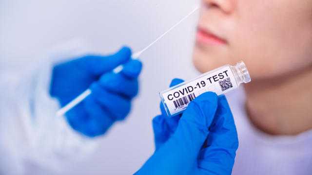 Doctor in protective gloves & workwear holding Testing Kit for the coronavirus test 