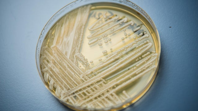 Experts warn of newly-discovered yeast 