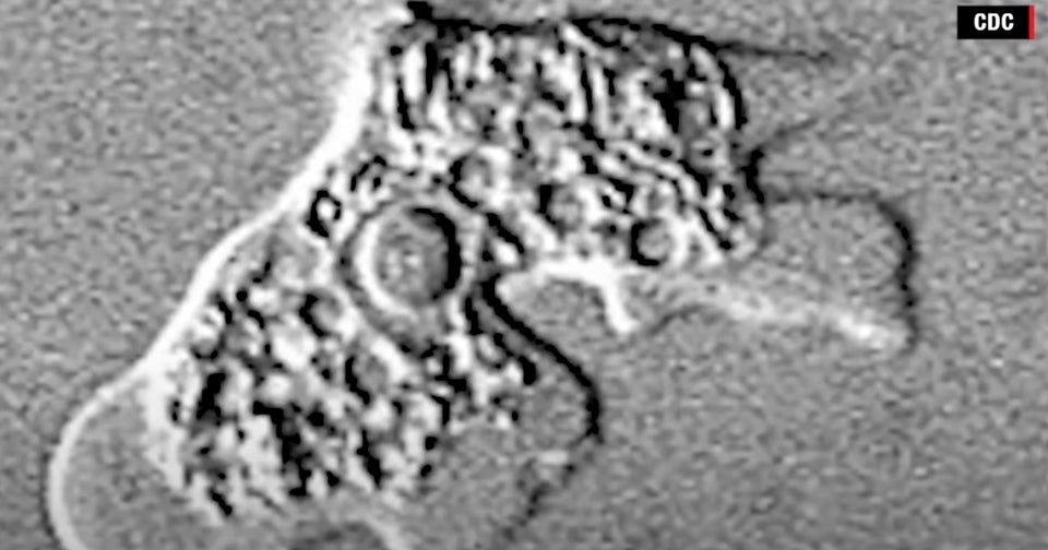BrainEating Amoeba Kills Tehama County Boy CBS San Francisco(02)