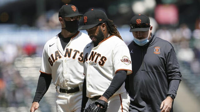 Cueto-injury-AP-Photo.jpg 