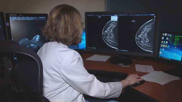 BREAST-CANCER-PATIENT-5PKG.transfer_frame_1822.jpeg 