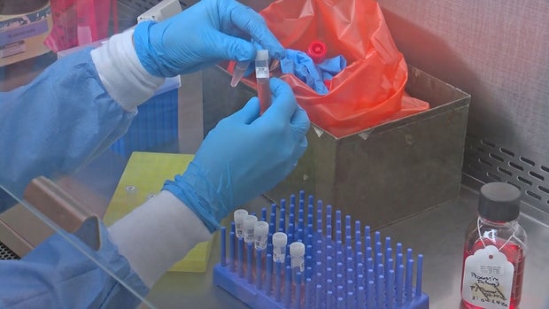 OMICRON UPDATE 5PKG.transfer_frame_1653