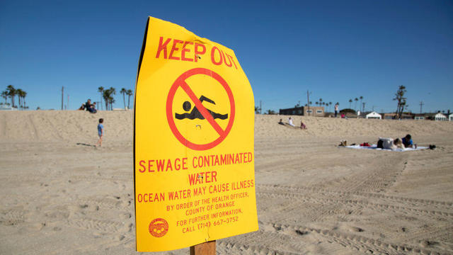 beach closure southern california sewage spill seal beach long beach huntington beach point fermin 