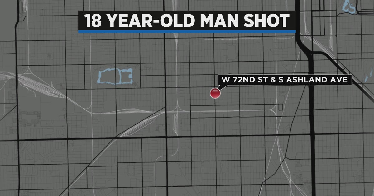 Man In Critical Condition After Being Shot In South Shore - CBS Chicago