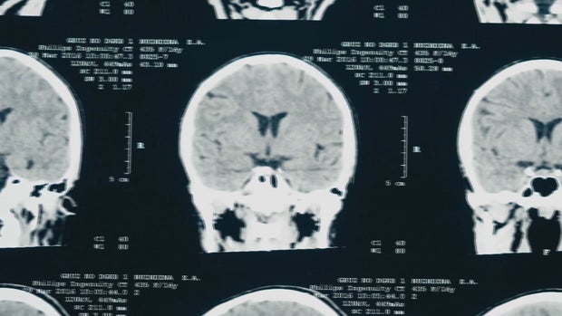 DENVER HEALTH REUNION.transfer_frame_823 