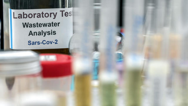 Wastewater samples for covid-19 analysis 