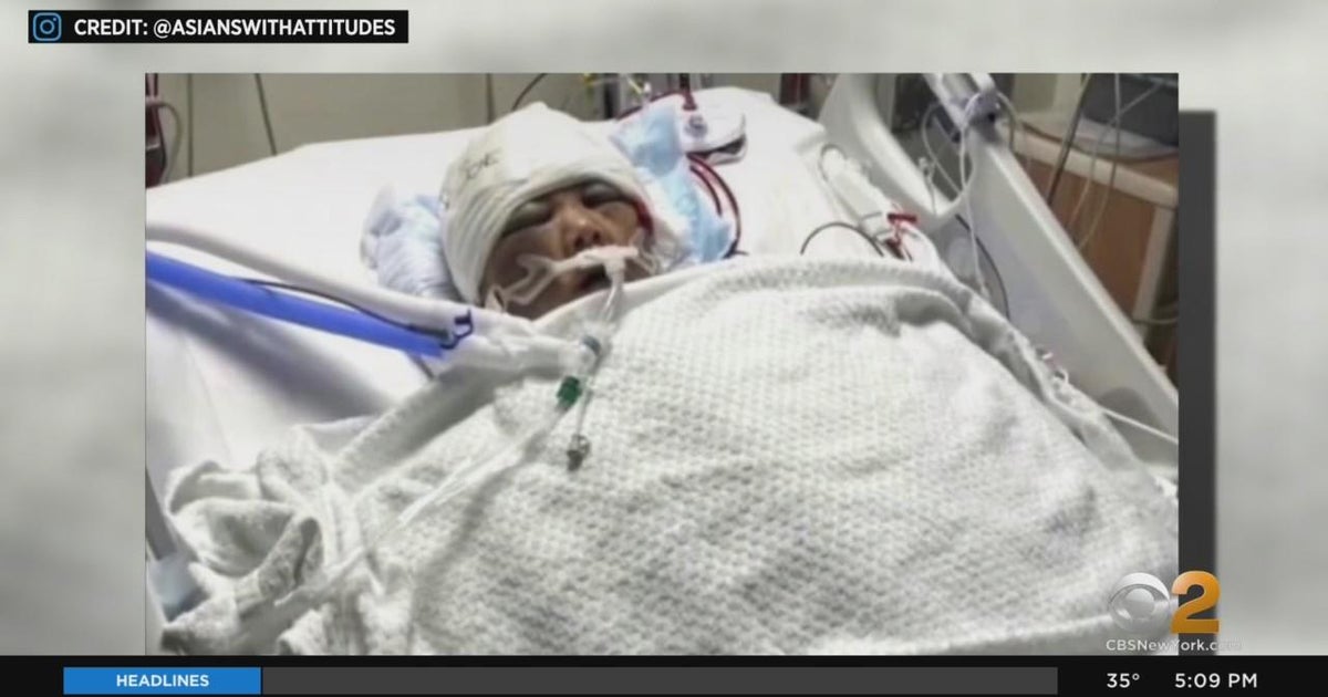 Grandmother from Queens dies after rock attack - CBS New York