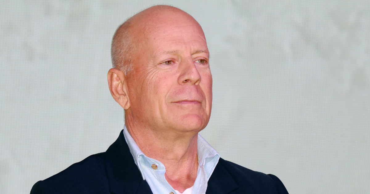 What’s frontotemporal dementia? Bruce Willis’ analysis, defined