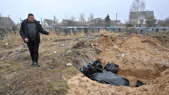 TOPSHOT-UKRAINE-RUSSIA-CONFLICT 