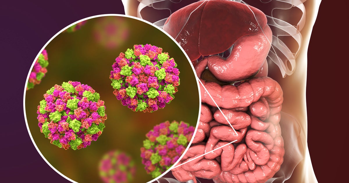 While COVID Is Declining, Cases Of Stomach Flu Are Rising CBS Boston