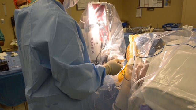 DENVER-HEALTH-EPILEPSY-63PKG.transfer_frame_1514.jpeg 