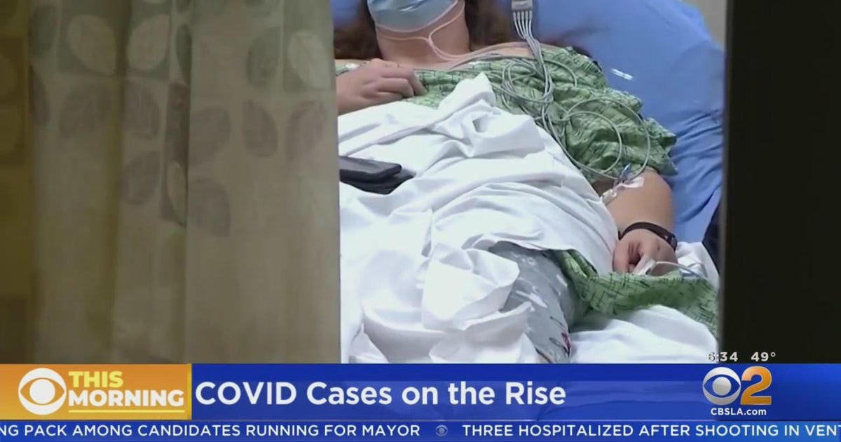LA County sees rise in COVID cases due to BA.2 - CBS Los Angeles