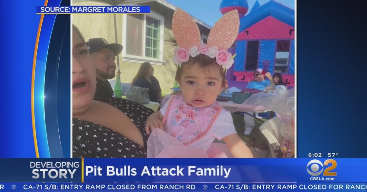 Oneyearold girl wounded in family pit bull attack in her Pico Rivera