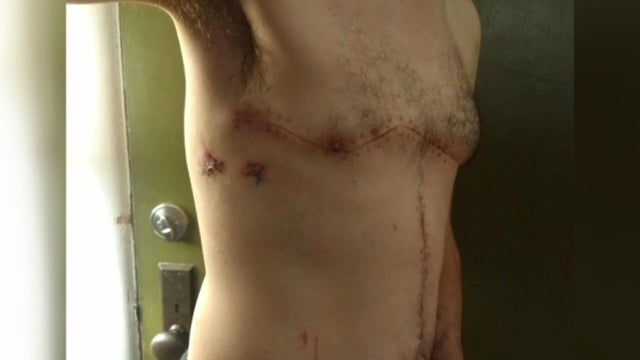 STABBED JUDGE 10 PKG.transfer_frame_2740 