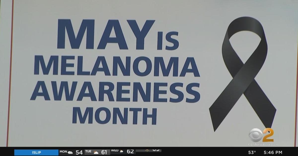 Melanoma Awareness Month begins CBS New York