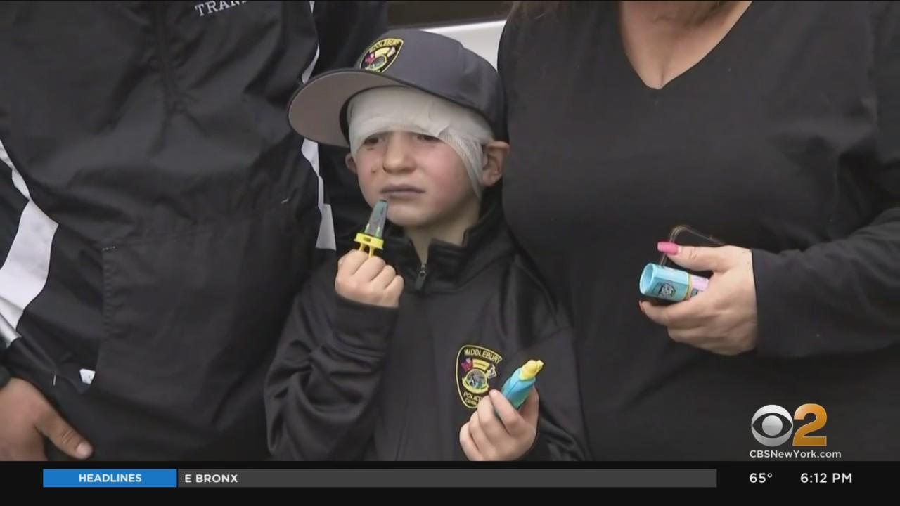 Yankees host Bridgeport boy burned by gasoline