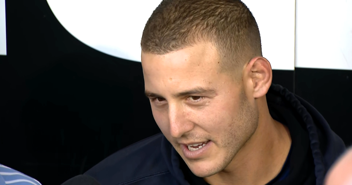 Former Cub Anthony Rizzo returns to Chicago as Yankees take on White Sox -  CBS Chicago