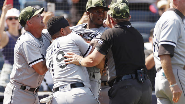 Michael Kopech struggled in his start while dealing with a respiratory issue