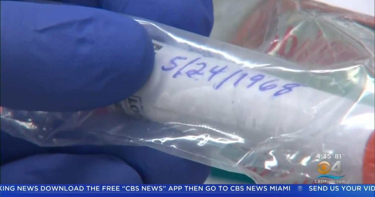 First Presumptive Case Of Monkeypox Detected In Broward - CBS Miami