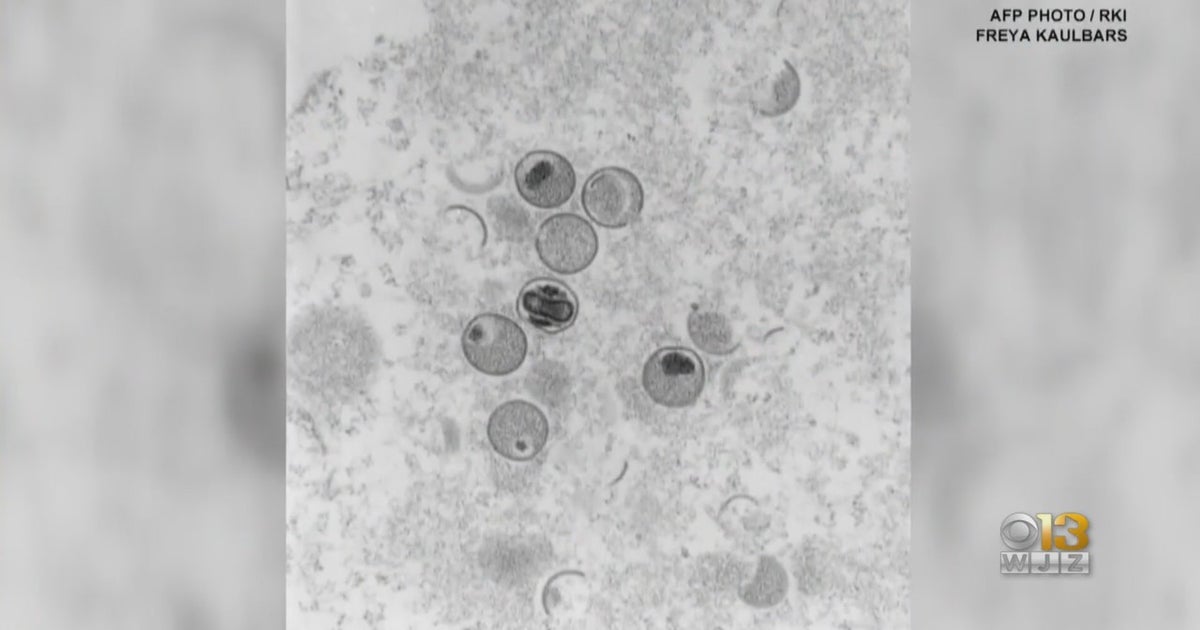 Hopkins Experts Watch Spread Of Monkeypox As Cases Inch Closer To ...
