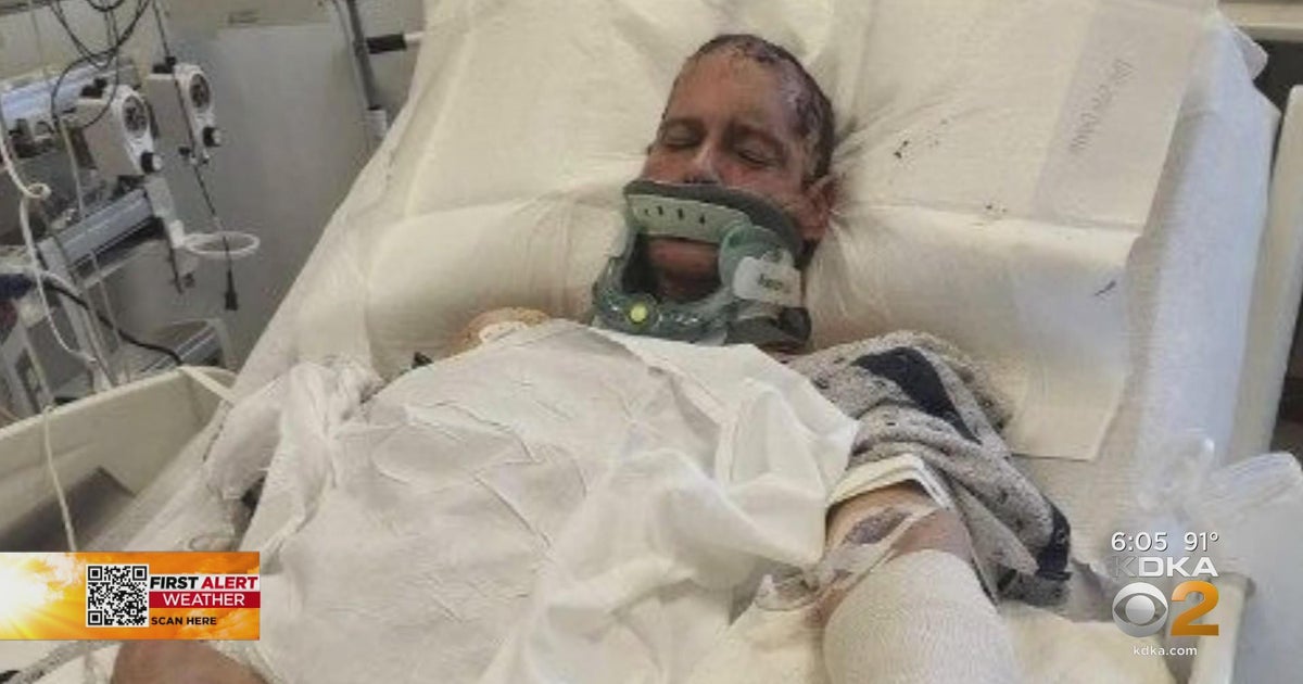 Man attacked with brick in New Kensington - CBS Pittsburgh