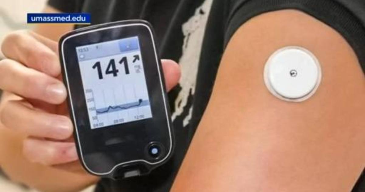 Continuous Glucose Monitoring Near Me in Little Rock, AR