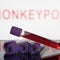 WHO considers declaring monkeypox a global health emergency