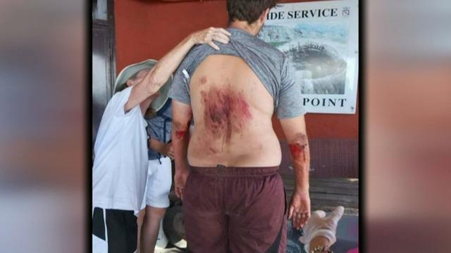 cbsn-fusion-us-tourist-survives-fall-into-mount-vesuvius-crater-thumbnail-1121832-640x360.jpg 