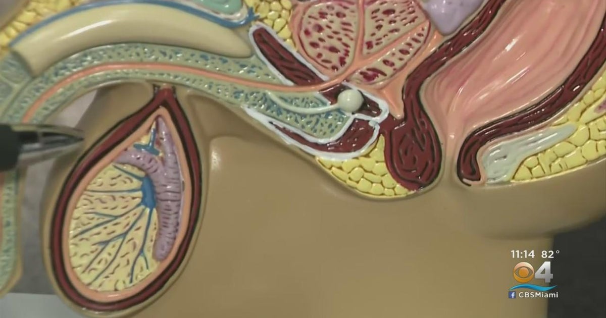 Supreme Court’s decision to overturn Roe v. Wade leads to increased interest in vasectomies